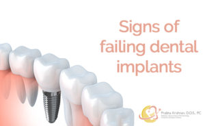 Save dental implants with LAPIP