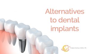 Alternatives to Dental Implants